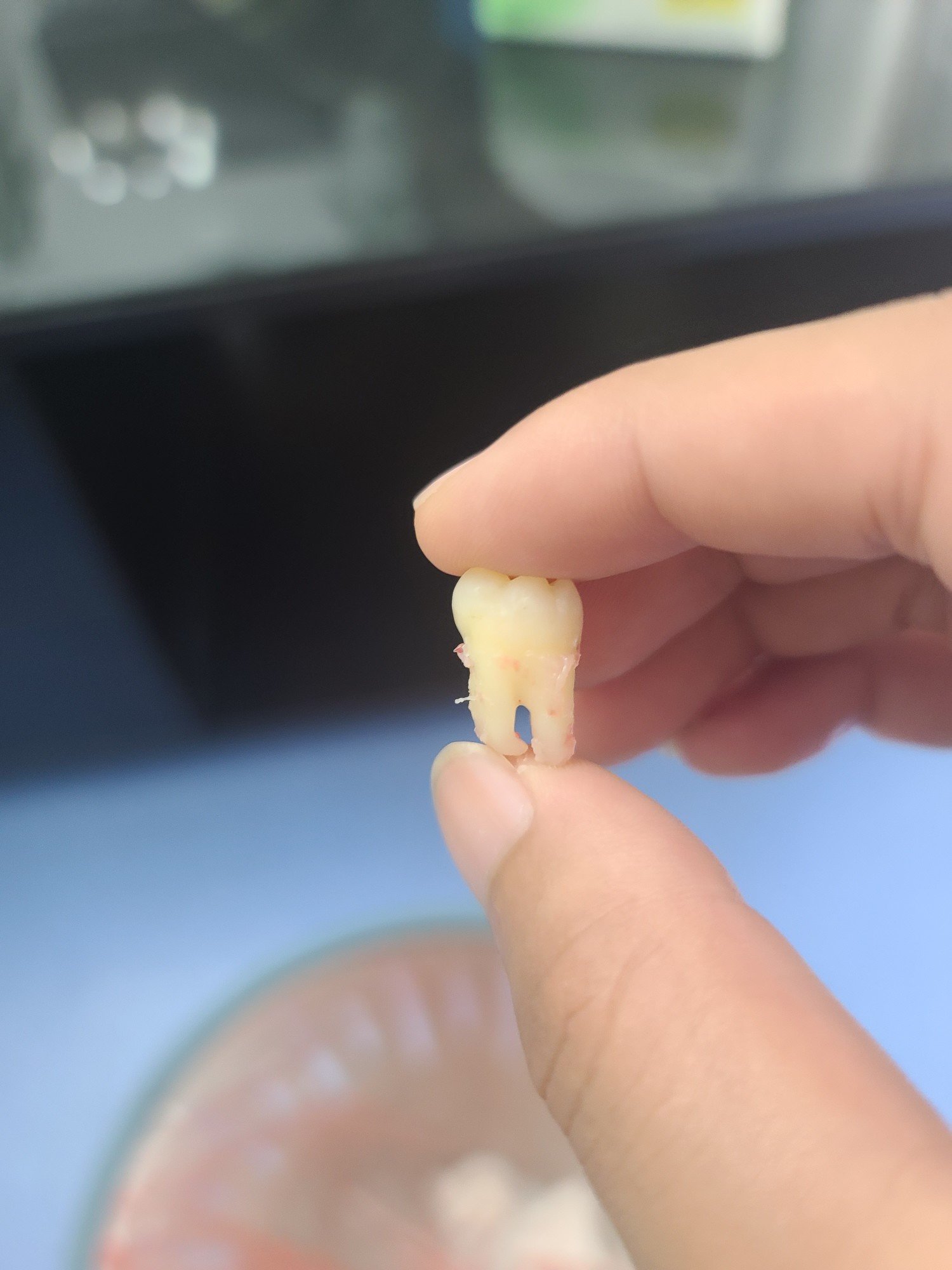 刚拔的智齿慎入