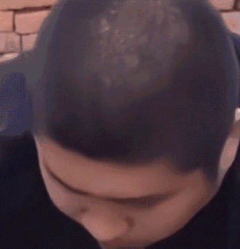 联合军项链问题1