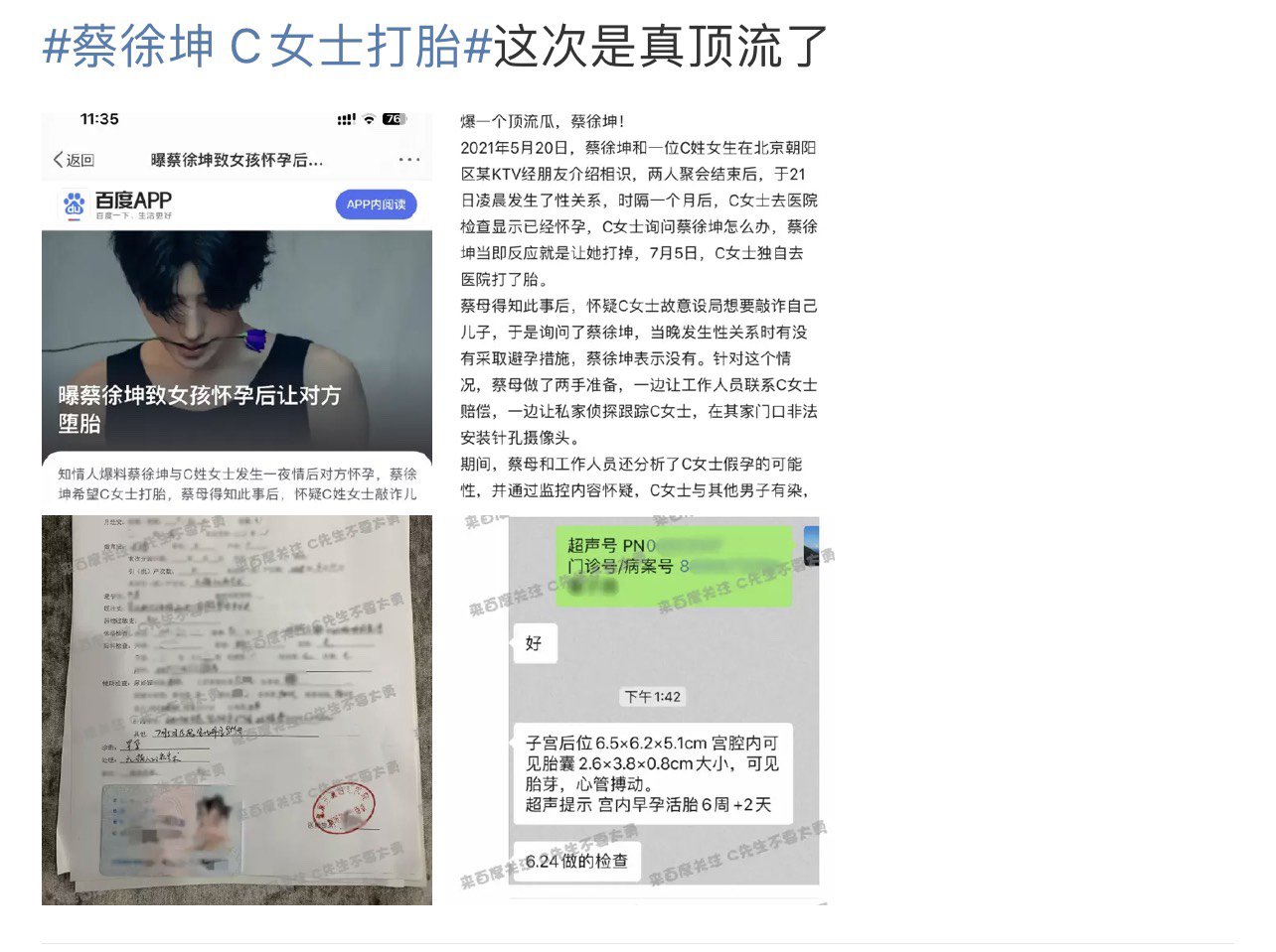 红背带裤恐成绝唱1