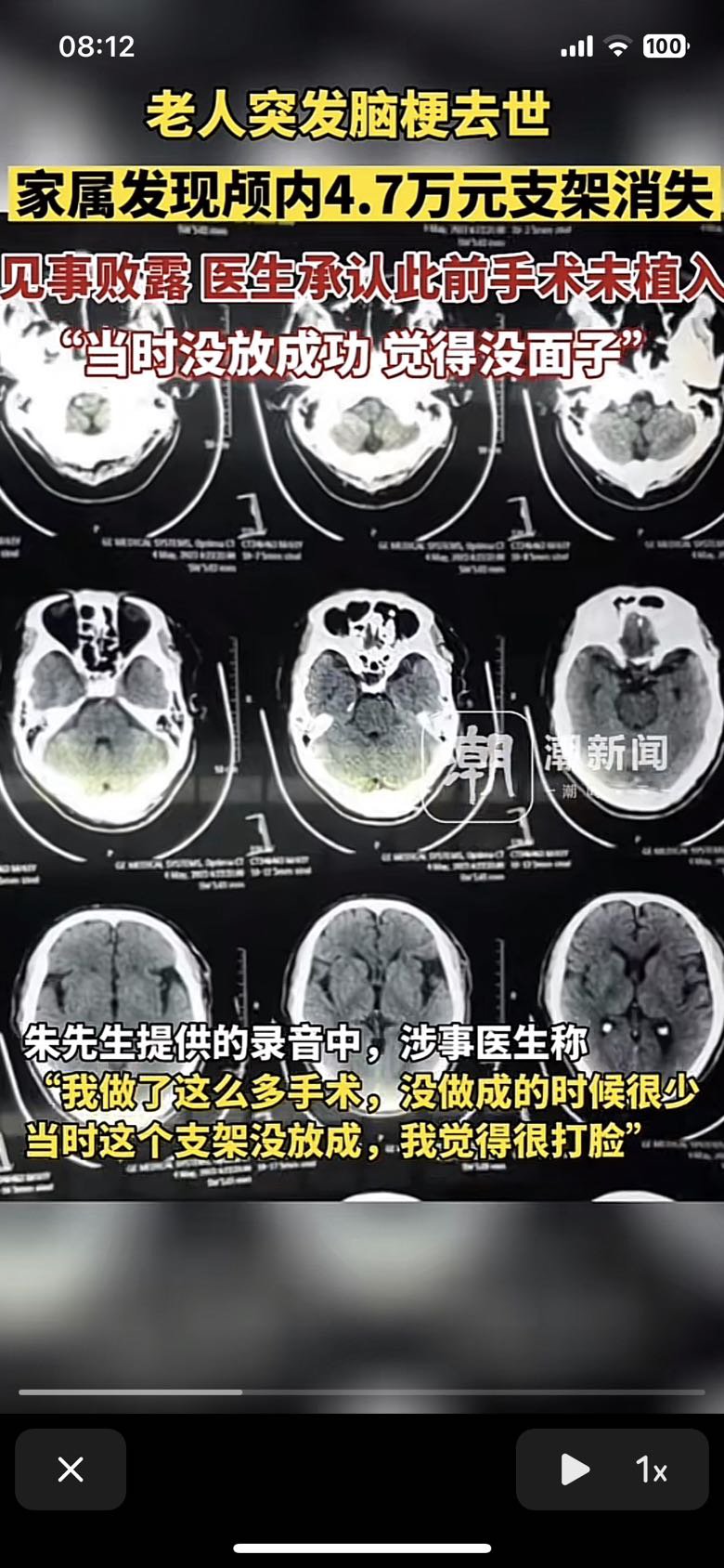 因为事件太过离谱以至于我分不清真假2