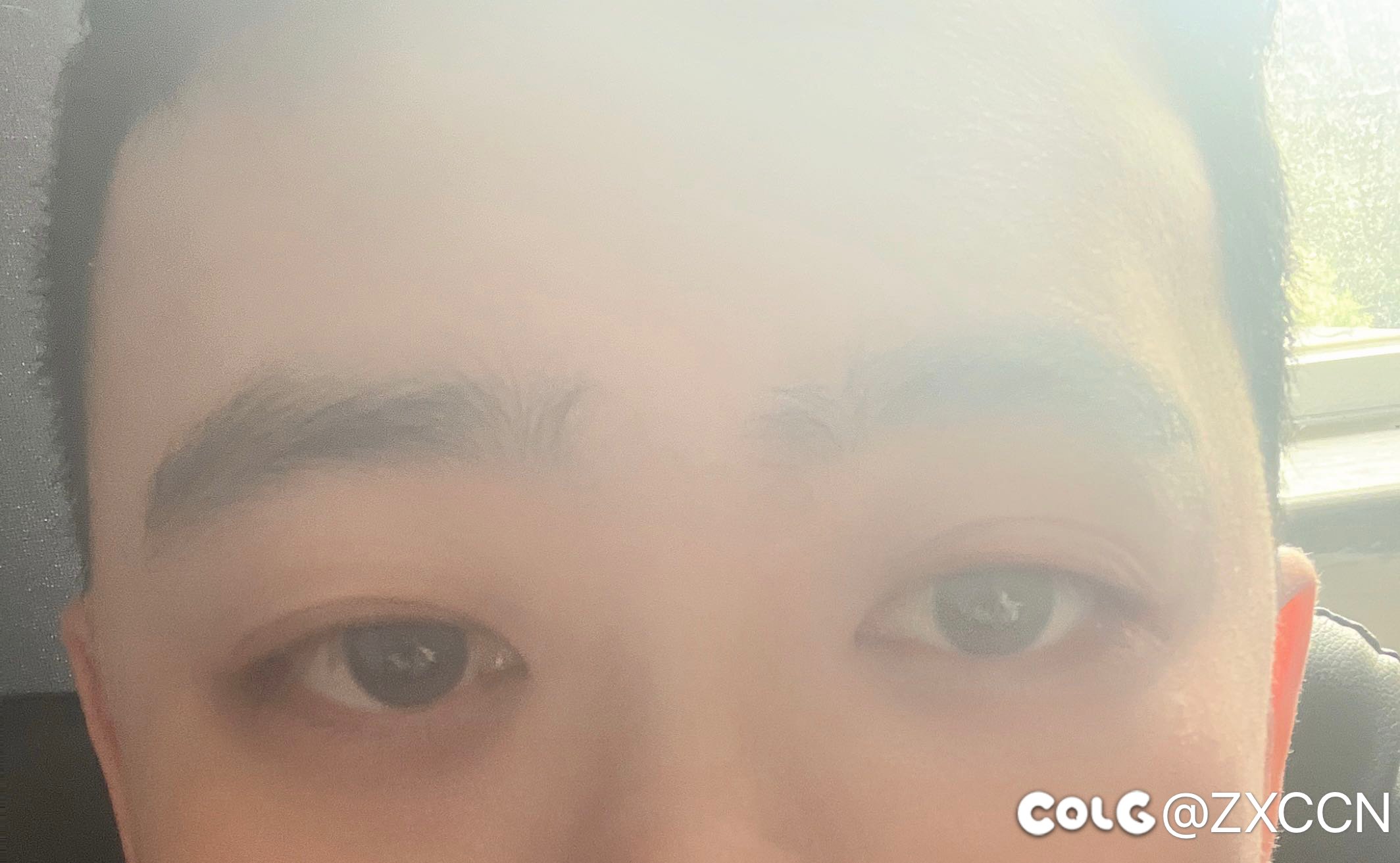 有做过双眼皮的朋友们吗？我这种情况可以去做双眼皮吗？2