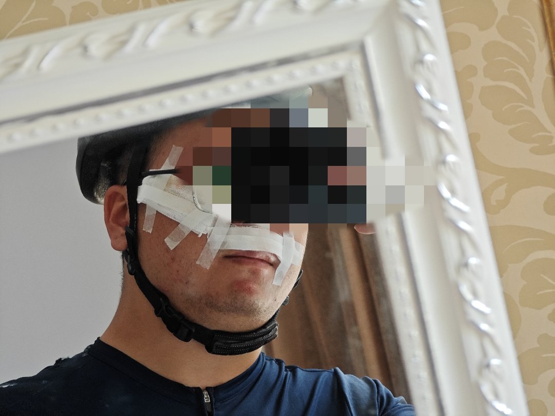 发个糖，庆祝下爬山摔车狗命还在6