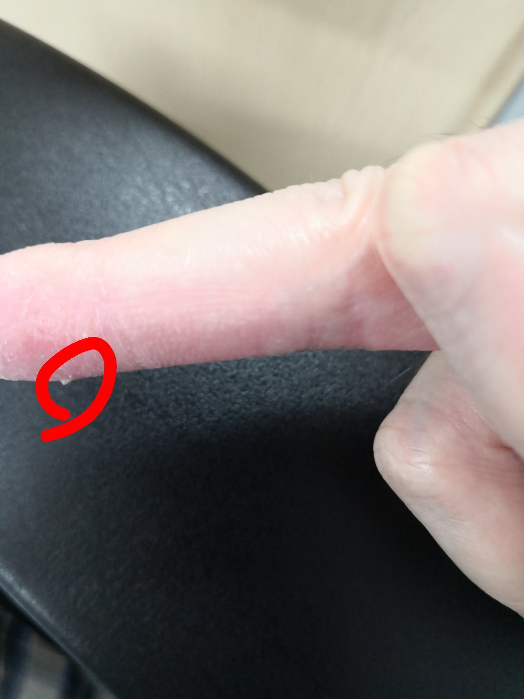 有人跟我一样有这个情况吗2
