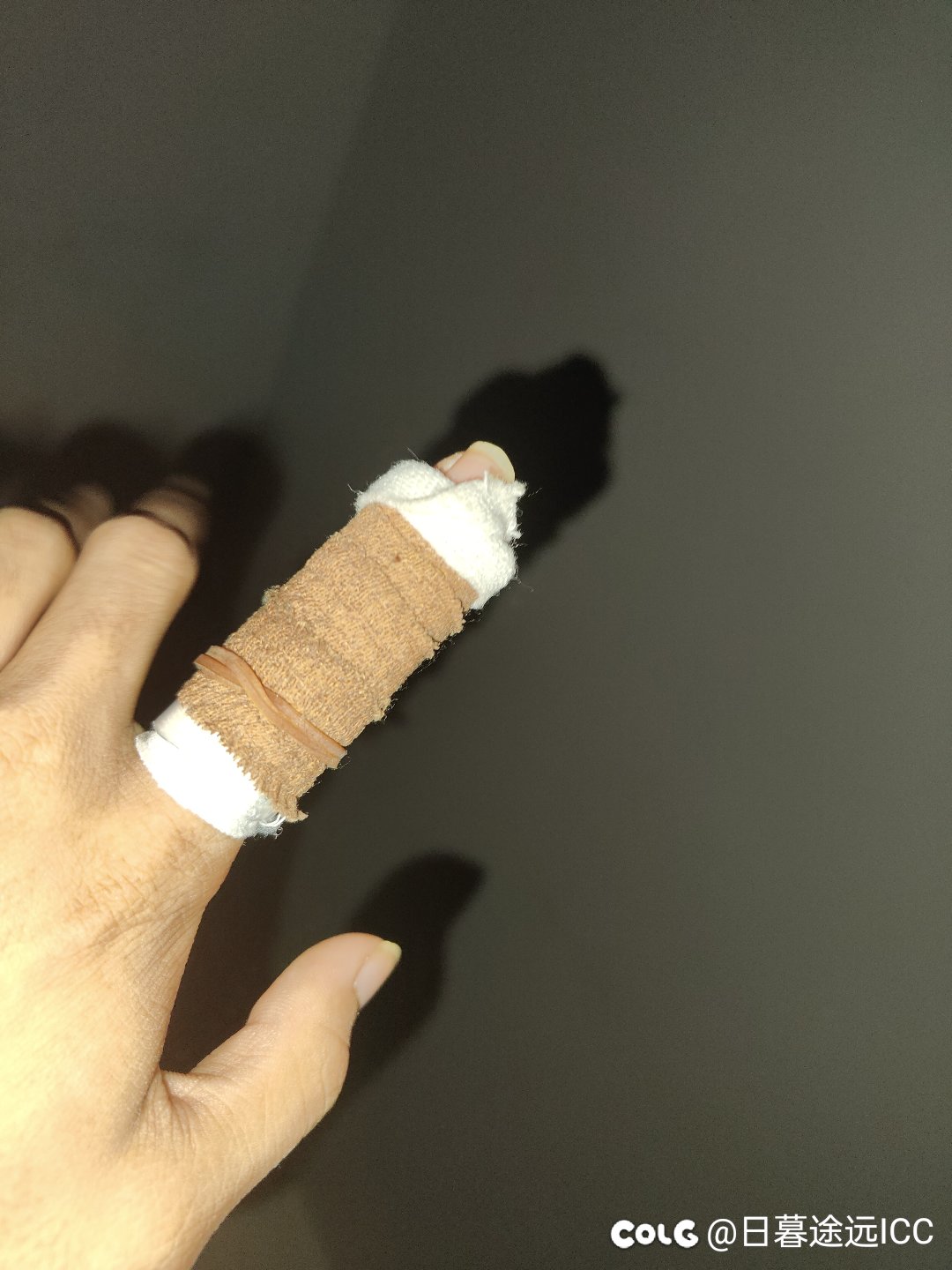 左手食指骨折了，帕拉丁转精灵骑士能操作的过来吗2
