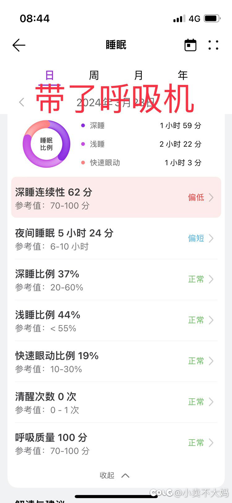 呼吸机佩戴前后数据3