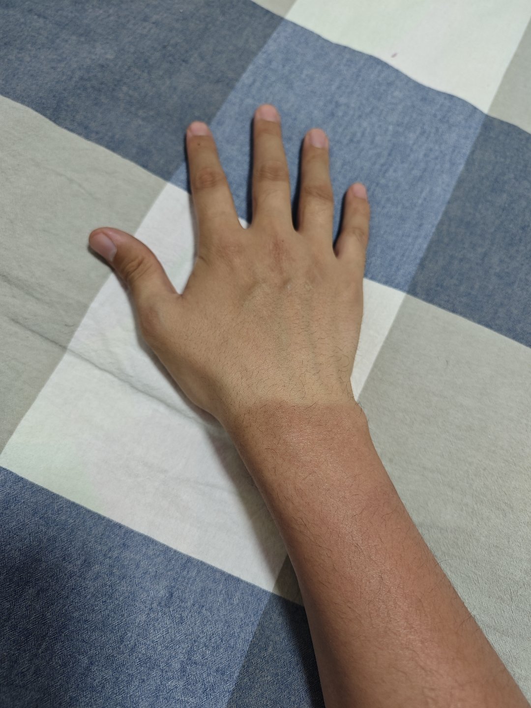 今天的爬山和晒伤，总结一下就是7