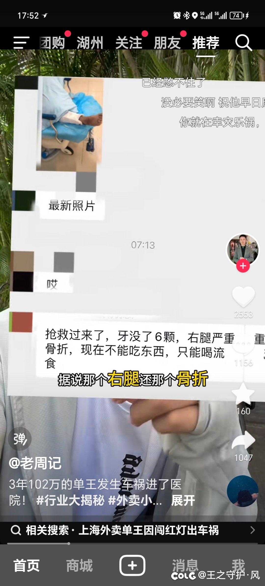3年102万是吧   ICU贵宾一位1