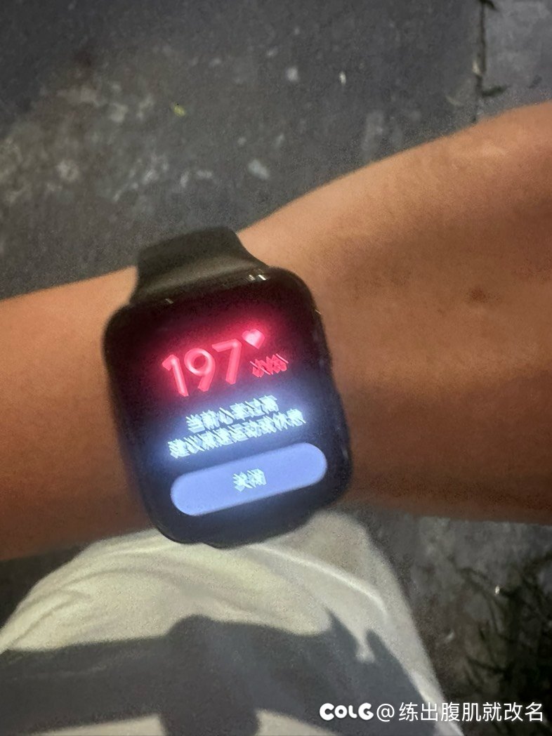 也不知道手表出问题了还是咋的1