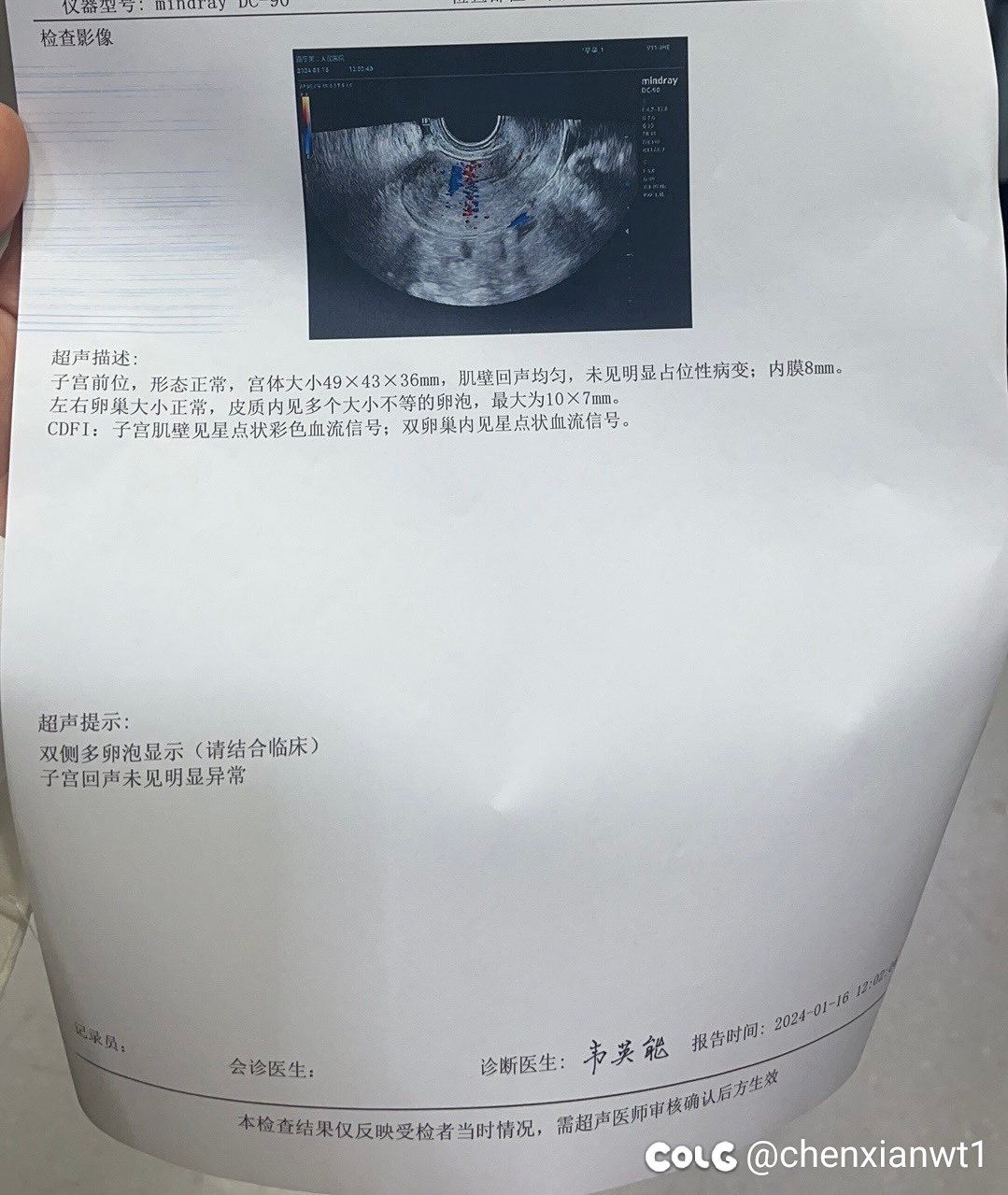 跨一某金团群主惊天大瓜。8