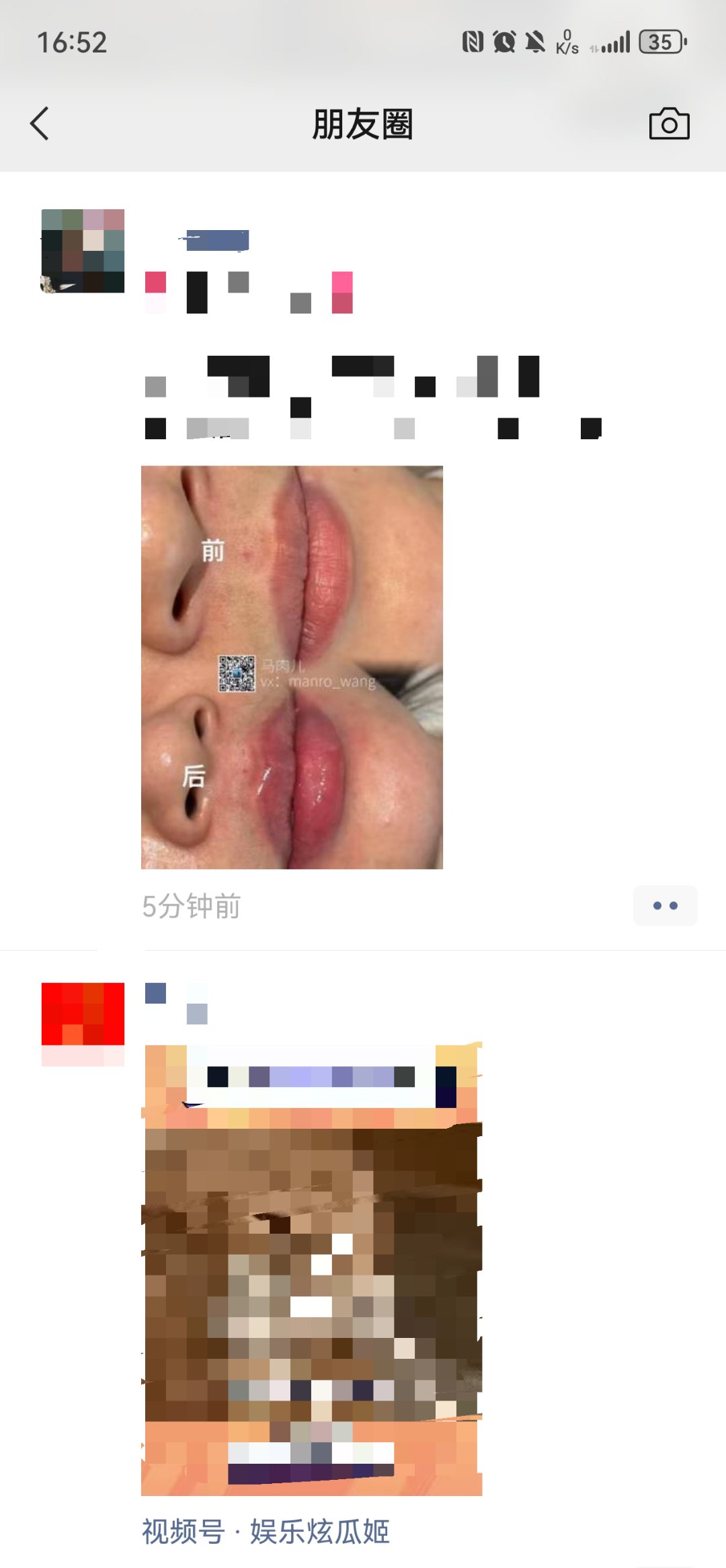 看朋友圈1