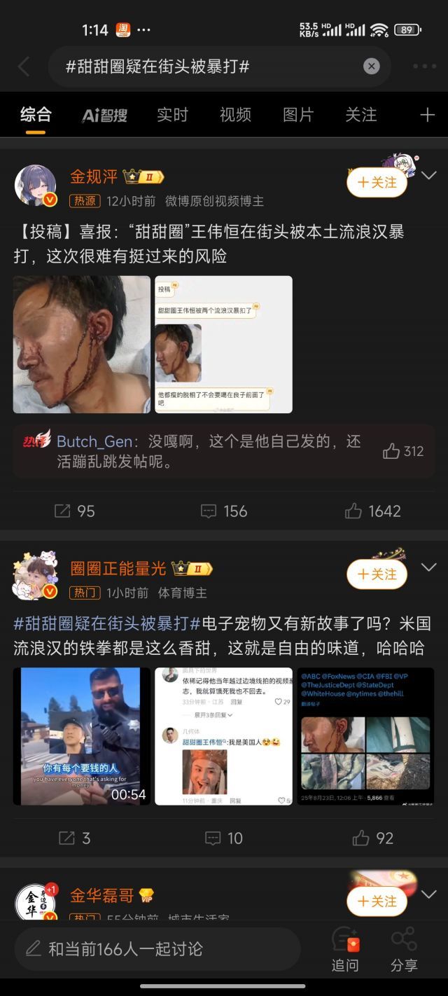 电子宠物回光返照了    甜甜圈在阿丑街头被打1