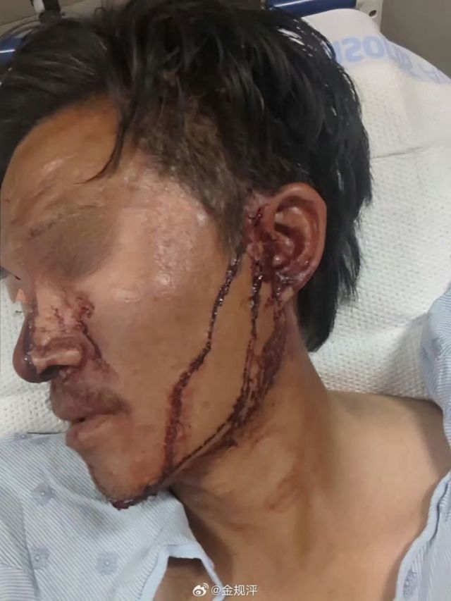 电子宠物回光返照了    甜甜圈在阿丑街头被打3