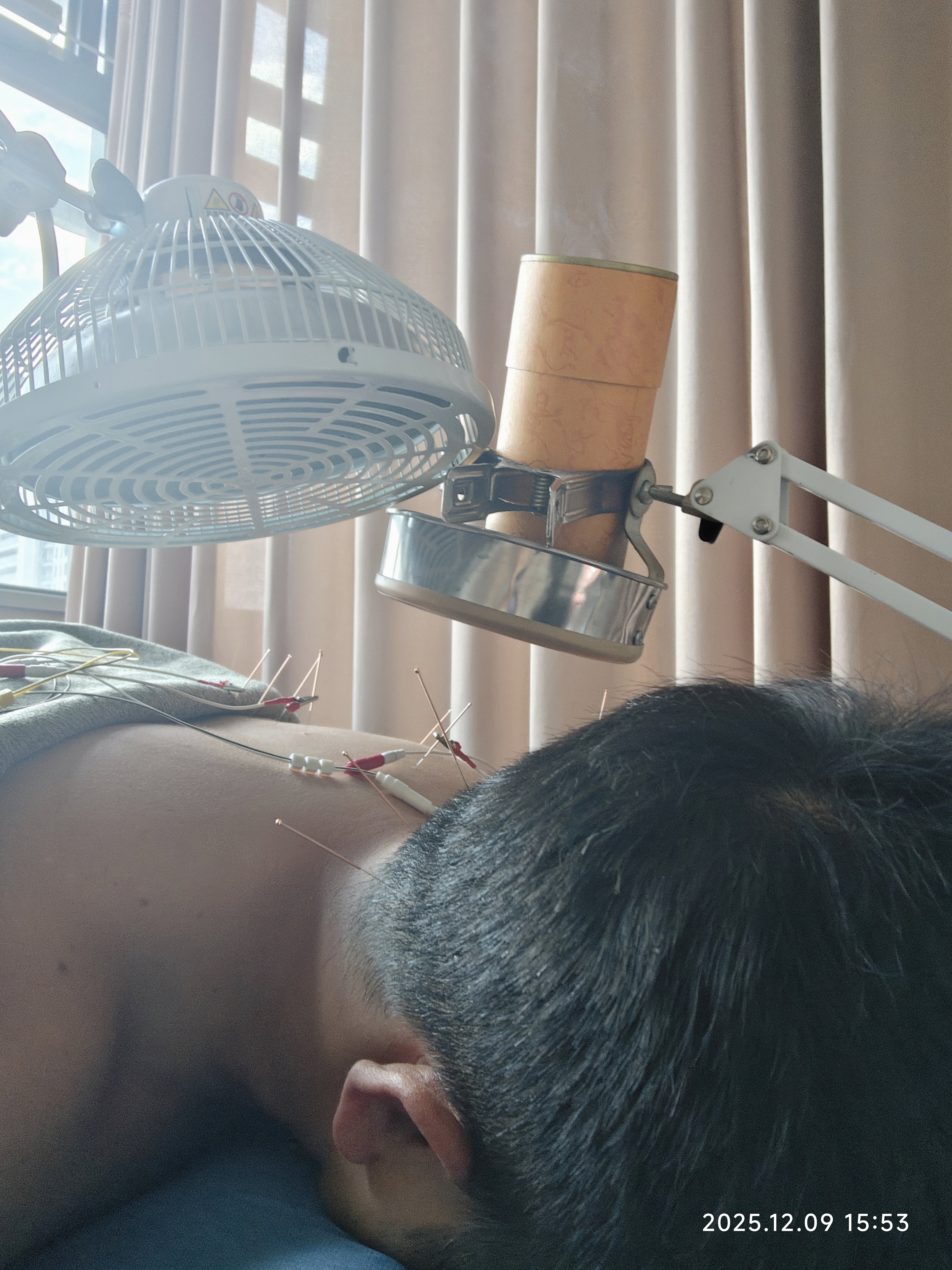 头一次听说打飞机把后背拉伤的1